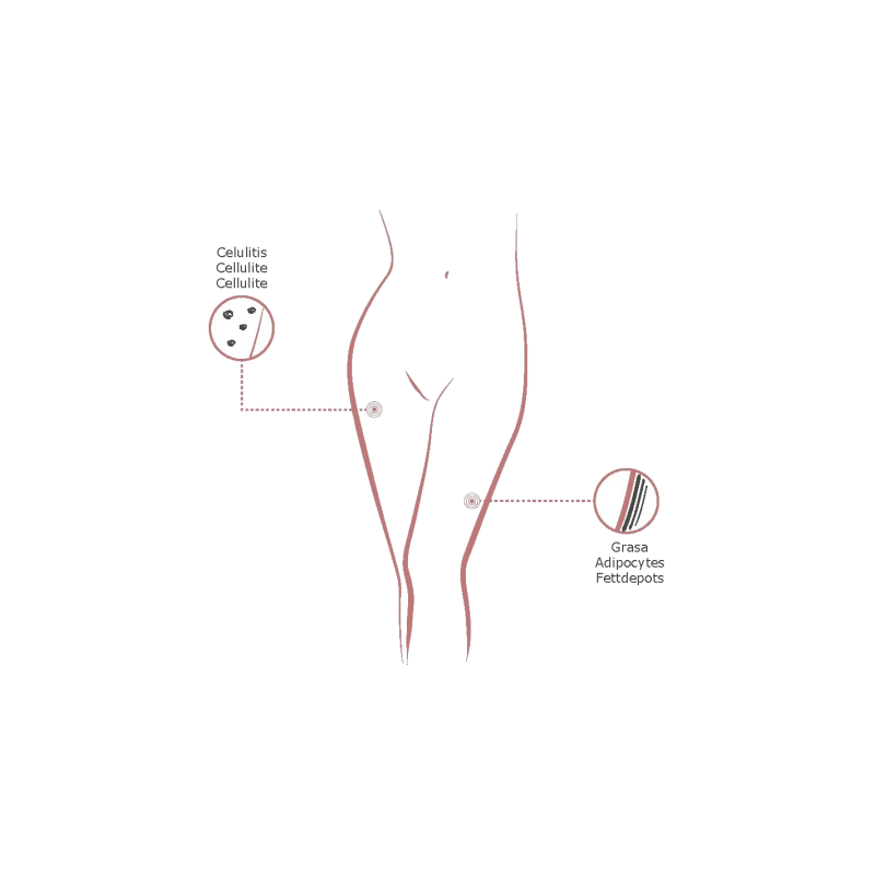 Pack Anticellulite | Produits de Mesotherapie