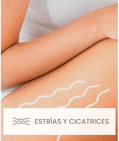 Estrías y cicatrices