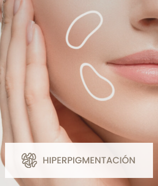 Hiperpigmentación