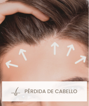 Pérdida de cabello